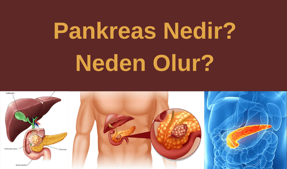 Pankreas Kanseri Nedir?  Neden Olur?